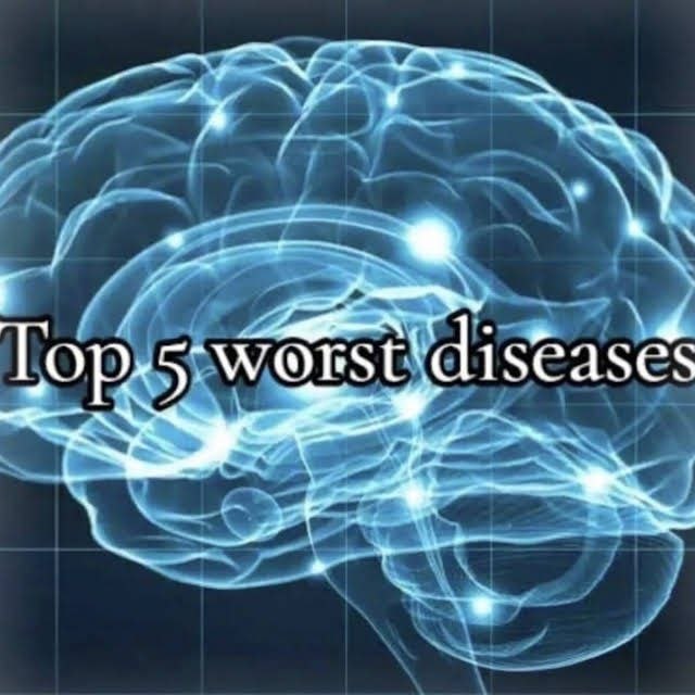4 Тор a diseases aN
