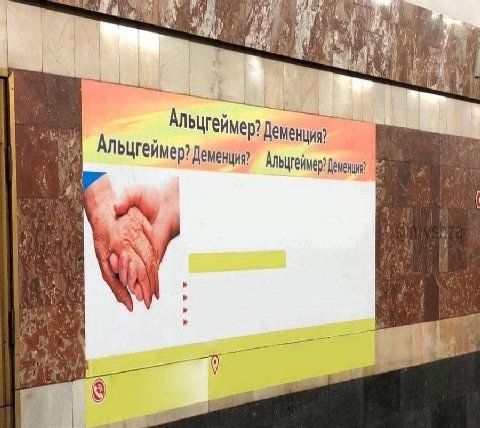 Any Альцгейм Деменция?