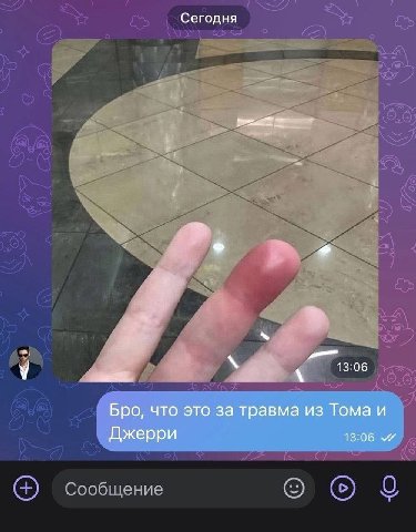 Сегодня 13:06 Бро, что это за травма из Тома и Джерри 13:06 О Сообщение