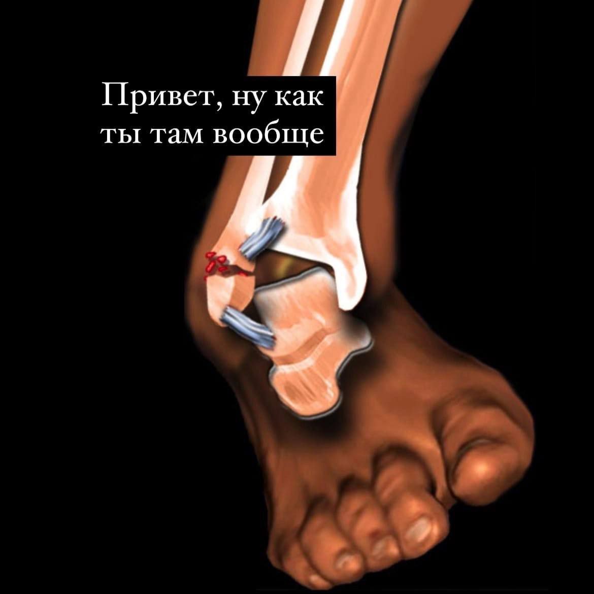 Привет, ну как ты там вообще