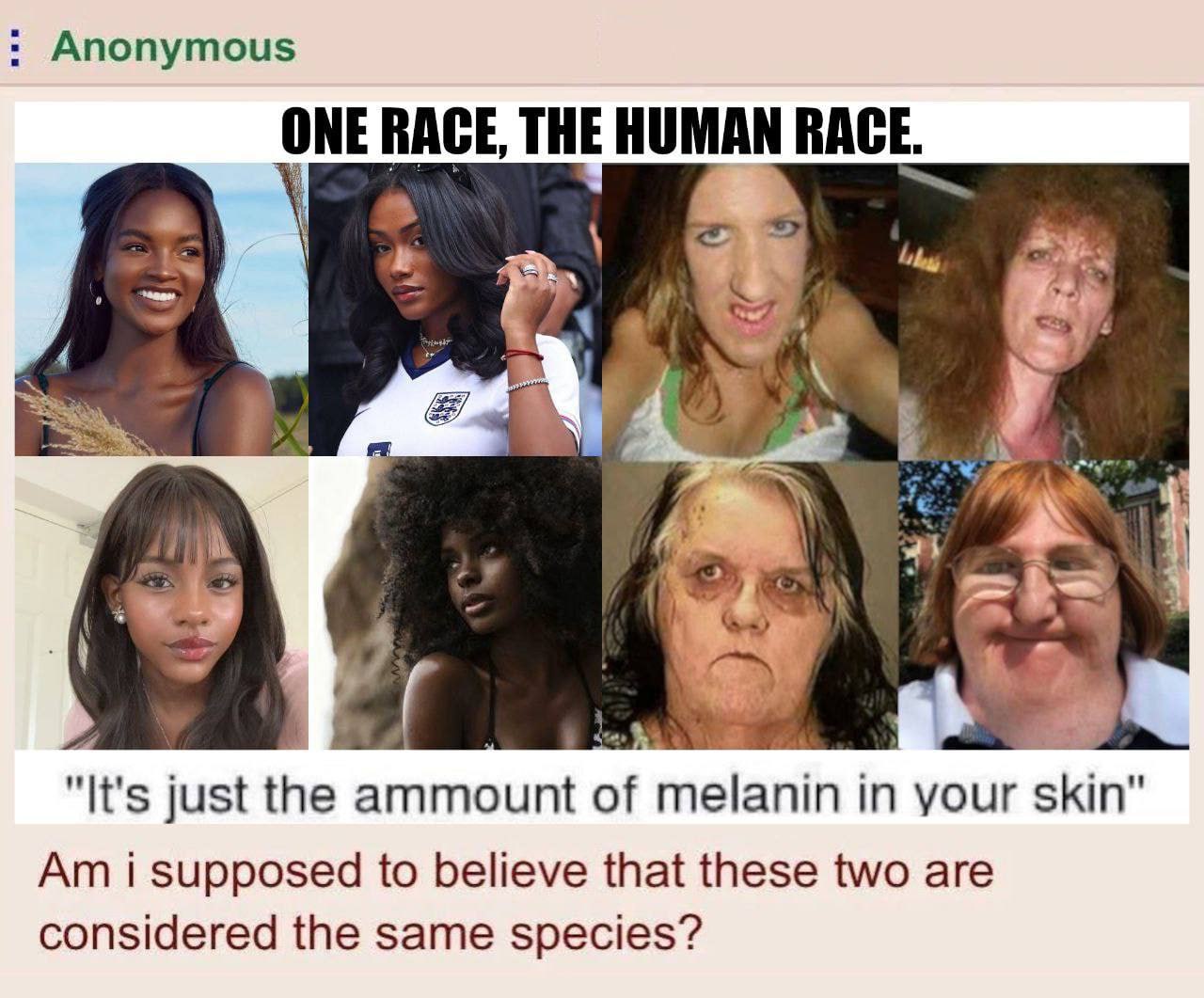 Anonymous THE HUMAN RACE. "It's just the ammount of in your skin’ i supposed to believe that these two are considered the same species?