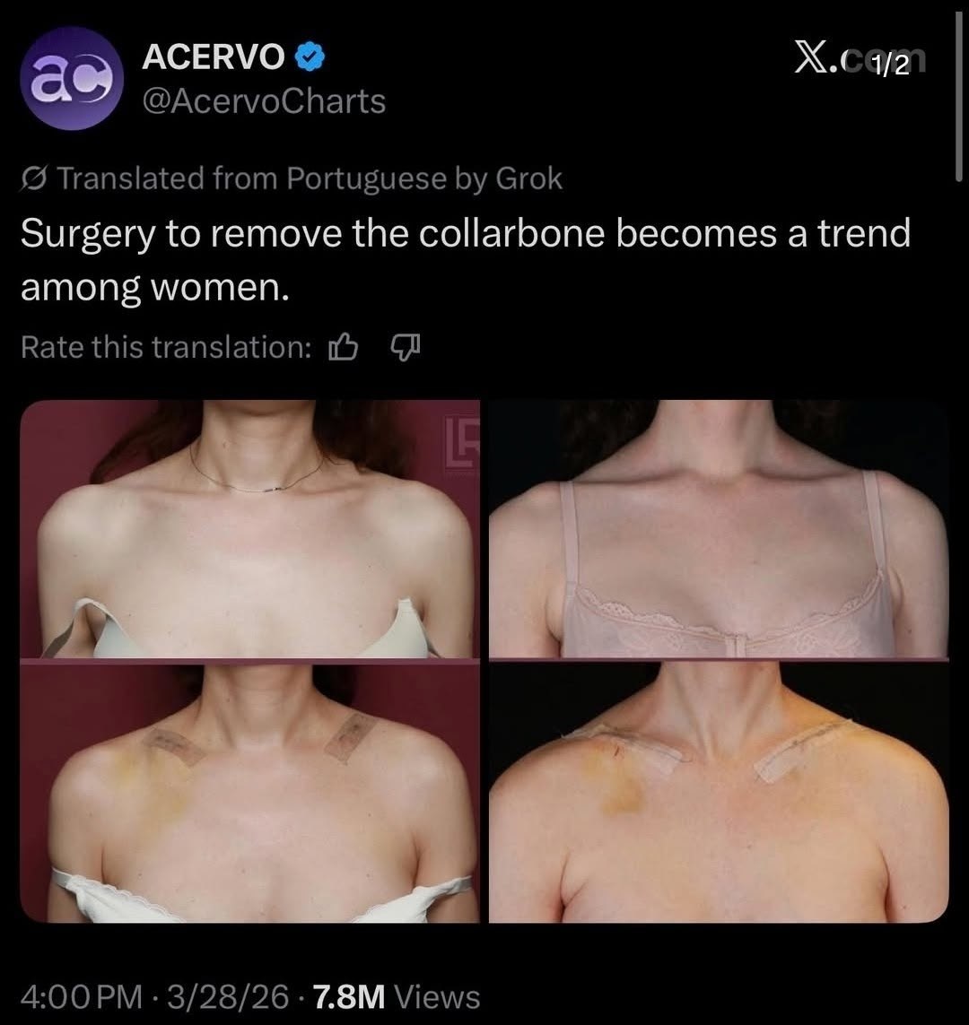 АСЕВУО as @AcervoCharts Translated from Portuguese Grok Surgery to remove the collarbone becomes a trend among women. Rate this translation: 4:00 3/28/26 Views