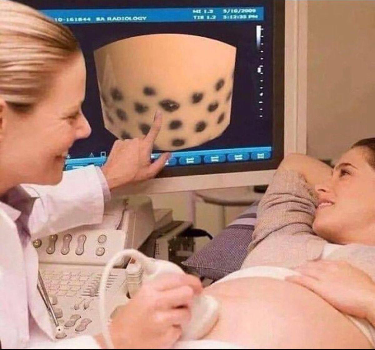 я