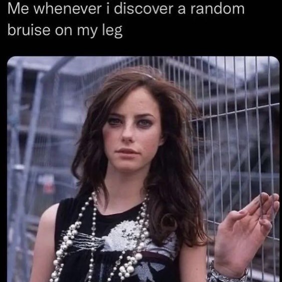 whenever discover a random bruise on my leg я
