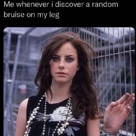 whenever discover a random bruise on my leg я