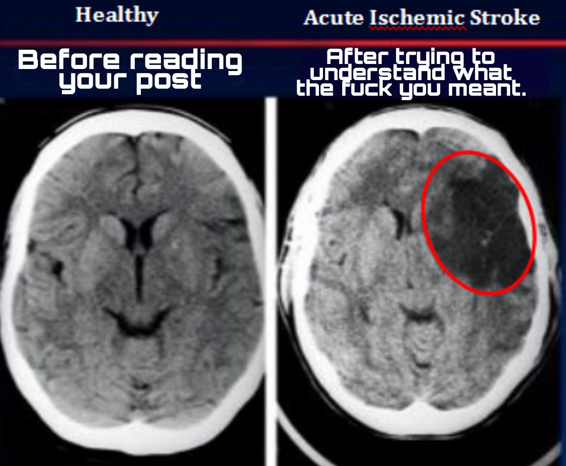 Healthy Acute Ischemic Stroke Before reading at your the Fuck meant. i