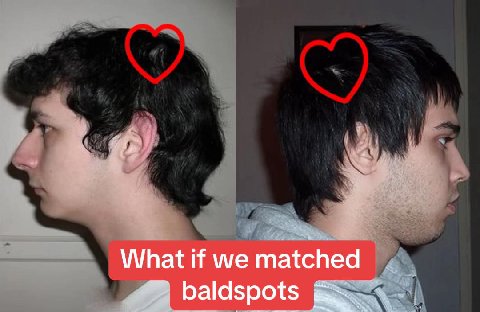 What if we matched baldspots