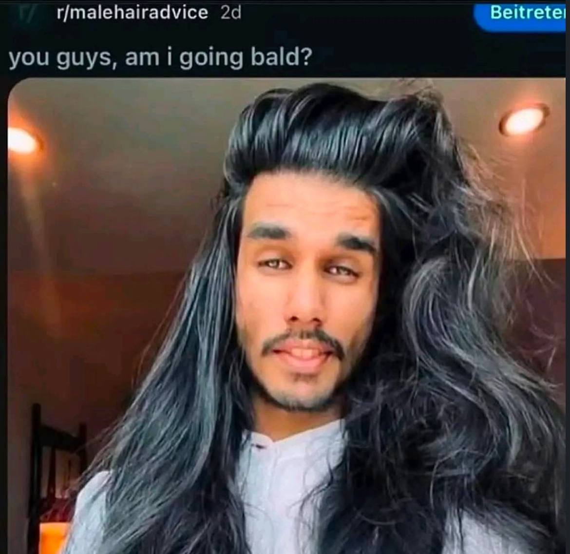 r/malehairadvice Вейгете! you guys, ami going bald? И 4 |1 4