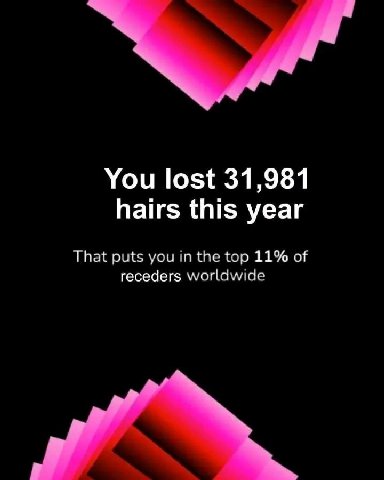 You lost 31,981 hairs this year That puts you in the top 11% of receders worldwide