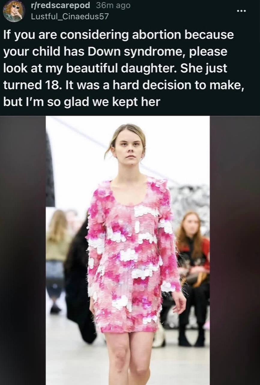 r/redscarepod ago Lustful_Cinaedus57 К you are considering abortion because your child has Down syndrome, please look at my beautiful daughter. She just turned 18. It was a hard decision to make, but 