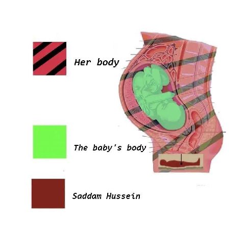 Her body The baby's body Saddam Hussein