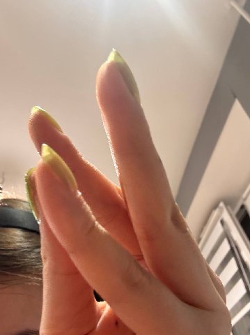 у
