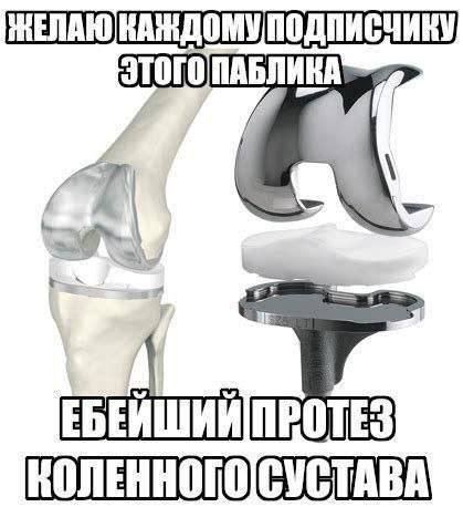ПРОТЕЗ