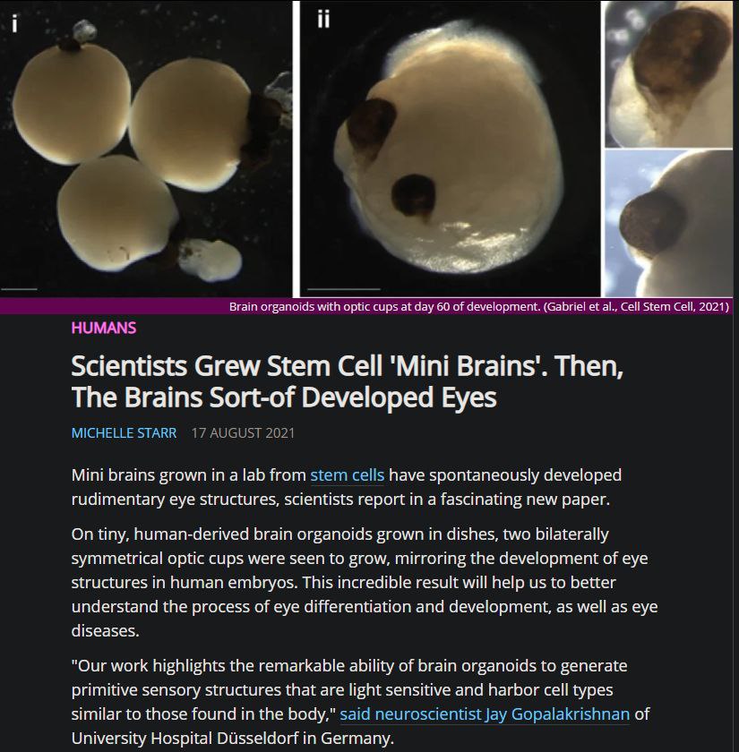 i у Brain organoids with optic cups at day 60 of development. (Gabriel Сей Stern Cell, 2021} HUMANS Scientists Grew Stem Cell Brains’. Then, The Brains Sort-of Developed Eyes STARR Mini brains grown i