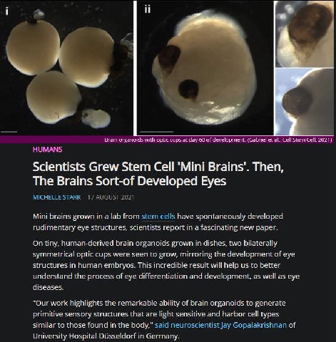 i у Brain organoids with optic cups at day 60 of development. (Gabriel Сей Stern Cell, 2021} HUMANS Scientists Grew Stem Cell Brains’. Then, The Brains Sort-of Developed Eyes STARR Mini brains grown i