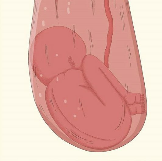 И