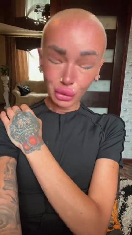 —5