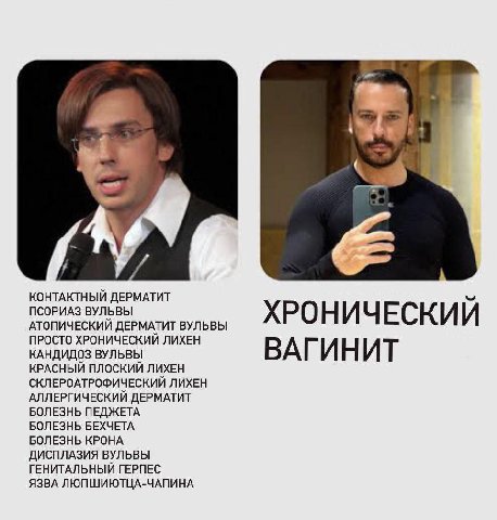 КОНТАКТНЫЙ ДЕРМАТИТ ПСОРИАЗ ВУЛЬВЫ ХРОНИЧЕСКИЙ АТОПИЧЕСКИЙ ДЕРМАТИТ ВУЛЬВЫ ПРОСТО ХРОНИЧЕСКИЙ ЛИХЕН КАНДИДОЗ ВУЛЬВЫ ВАГИНИТ КРАСНЫЙ ПЛОСКИЙ ЛИХЕН скл ЕРОАТРОФИЧЕСКИЙ ЛИХЕН АЛЛЕРГИЧЕСКИИ ДЕРМАТИТ БОЛЕЗ