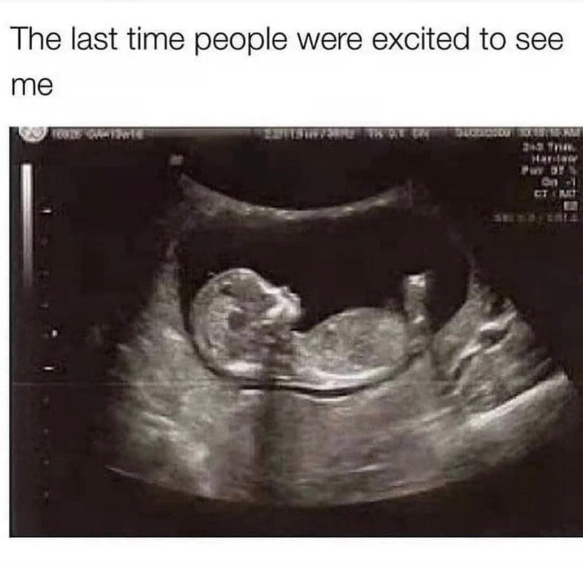 The last time people were excited to see me