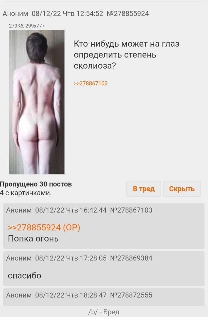 Аноним 08/12/22 Чтв 12:54:52 №278855924 If Кто-нибудь может на глаз определить степень сколиоза? >>278867103 Пропущено 30 постов В тред Скрыть 4 с картинками. Аноним 08/12/22 Чтв 16:42:44 №278867103 >
