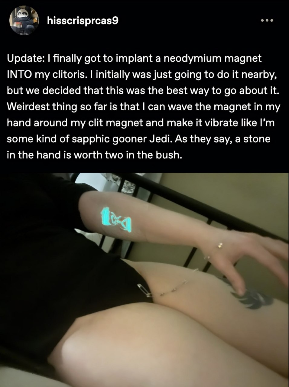 hisscrisprcas9 Update: finally got to implant a neodymium magnet INTO my clitoris. initially was just going to it nearby, but we decided that this was the best way to about it. Weirdest thing so far i