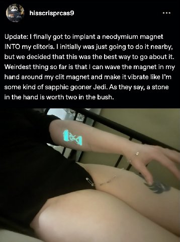 hisscrisprcas9 Update: finally got to implant a neodymium magnet INTO my clitoris. initially was just going to it nearby, but we decided that this was the best way to about it. Weirdest thing so far i