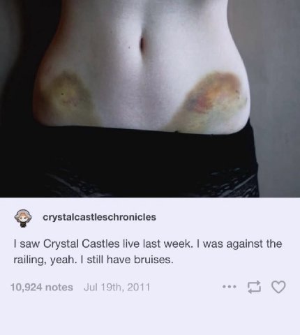 crystalcastleschronicles saw Crystal Castles live last week. was against the railing, yeah. still have bruises.