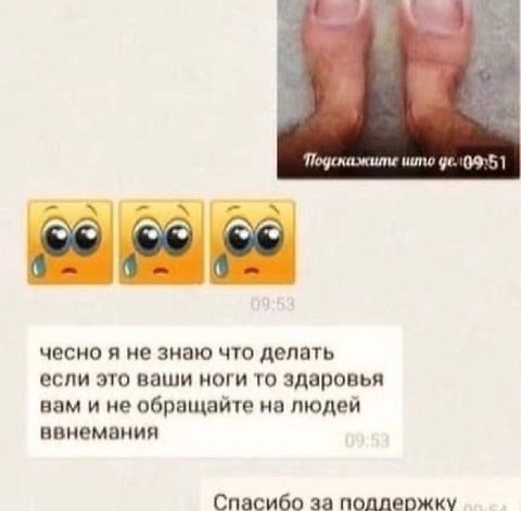Подскажите 56 чесно я не знаю что делать если это ваши ноги то здаровья вам и не обращайте на людей ввнемания Спасибо за поддержку