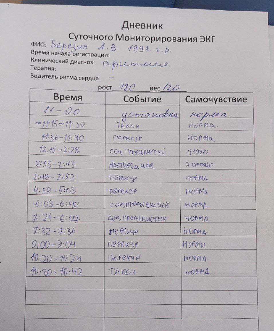Дневник Суточного Мониторирования ЭКГ ФИО: Время начала ‘регистрации: 2 Клинический диагноз: Терапия: Водитель ритма сердца: _вес Время Событие Самочувствие 11-90 а 12:45 Сон, 6:03 9:00=9:04 19:50 40: