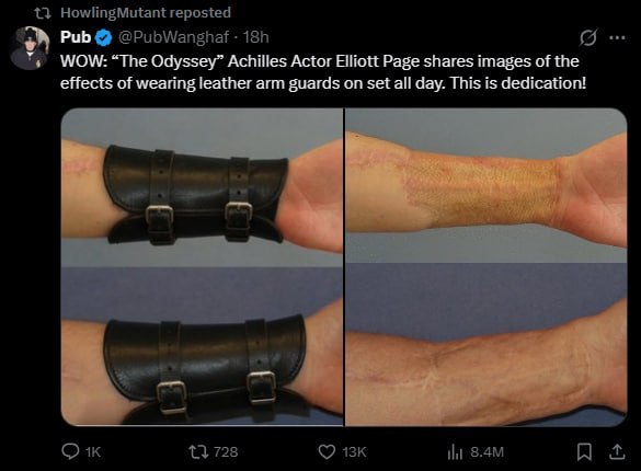 {3 HowlingMutant reposted Pub @PubWanghaf WOW: “The Odyssey” Achilles Actor Elliott Page shares images of the effects of wearing leather arm guards on set all day. This is dedication! 13 728 В