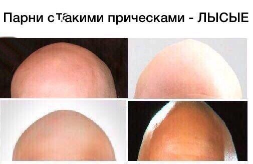 Парни сТакими прическами ЛЫСЫЕ