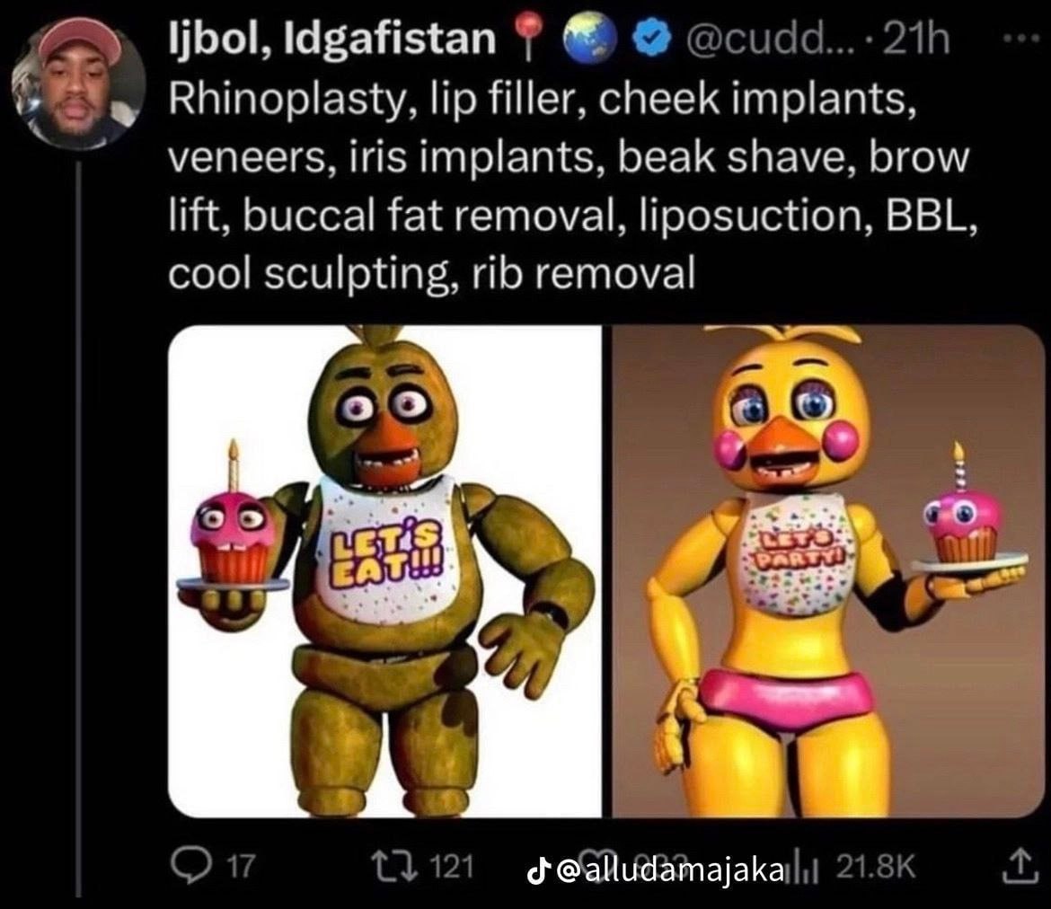 \jbol, @cudd... Rhinoplasty, lip filler, cheek implants, veneers, iris implants, beak shave, brow lift, buccal fat removal, liposuction, BBL cool sculpting, rib removal НИ