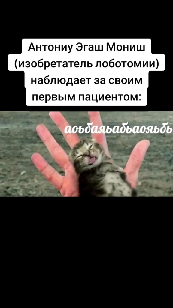 Антониу Эгаш Мониш (изобретатель лоботомии) наблюдает за своим первым пациентом: ы ‚ `@оъбаяьадьаояьбь