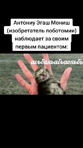 Антониу Эгаш Мониш (изобретатель лоботомии) наблюдает за своим первым пациентом: ы ‚ `@оъбаяьадьаояьбь