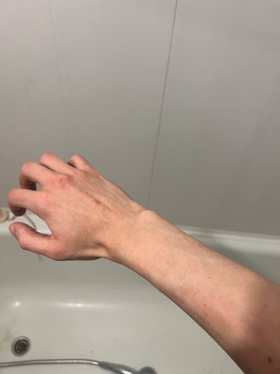 a 09