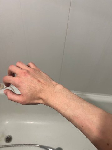 a 09