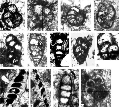 угадайте это картинка в популярной хайповой эстетике 👁horror weirdcore👁 или приложение к публикации о микрофауне и биостратиграфии позднего мезозоя и раннего кайнозоя?????