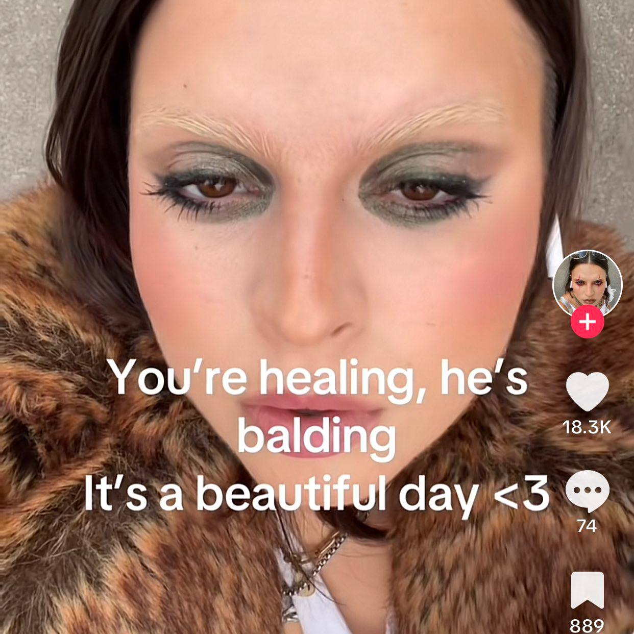You're healing, he’s balding It's a beautiful day <3