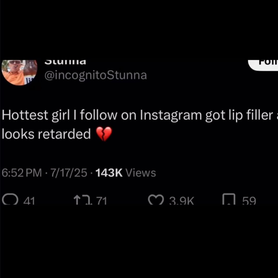 @incognitoStunna Hottest girl follow Instagram got looks retarded 6:52 7/17/25 Views a1 1.71 С зэк 59