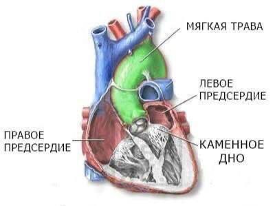 МЯГКАЯ ТРАВА ЛЕВОЕ ПРЕДСЕРДИЕ ПРАВОЕ КАМЕННОЕ ПРЕДСЕРДИЕ AHO