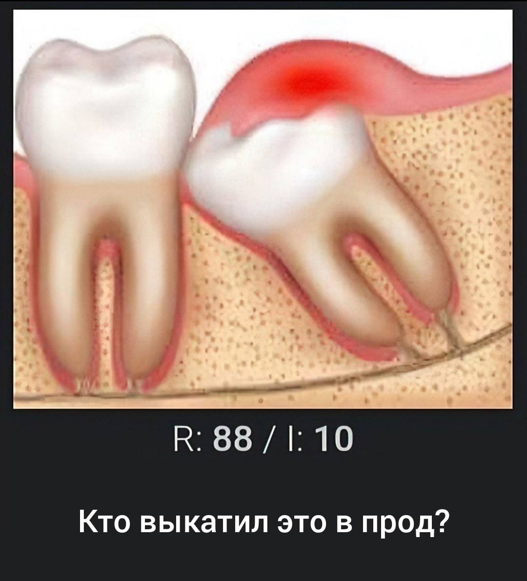 88 10 Кто выкатил это в прод?