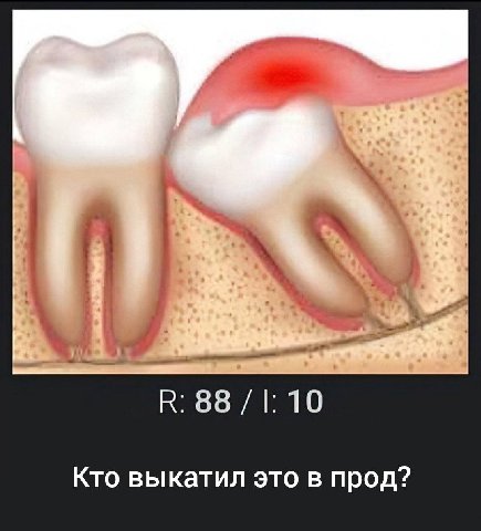 88 10 Кто выкатил это в прод?