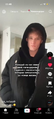 у меня крутой шрам на ребре у сердца
