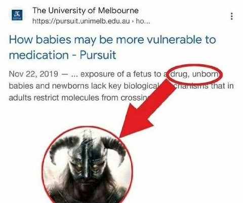 The University of Melbourne https://pursuit.unimelb.edu.au How babies may be more vulnerable to medication Pursuit Nov 22, 2019 exposure of a fetus to 4a babies and newborns lack key adults restrict m