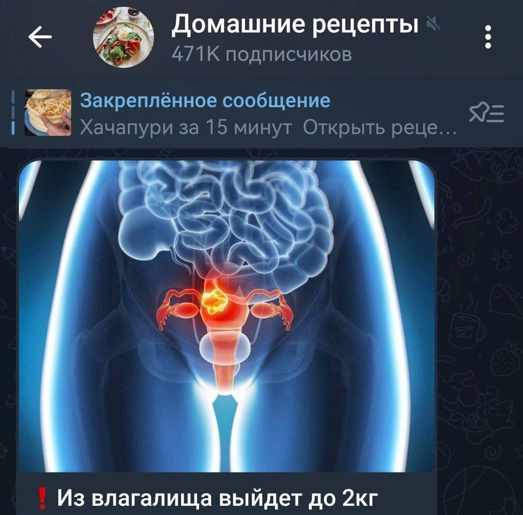 Домашние рецепты подписчиков Закреплённое сообщение 5 Хачапури за 15 минут Открыть реце... Из влагалища выйдет до