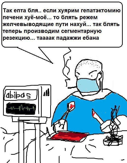 Так епта бля.. если хуярим гепатэктомию печени хуё-моё... то блять режем желчевыводящие пути нахуй... так блять теперь производим сегментарную резекцию... таааак падажжи ебана oN а и 9