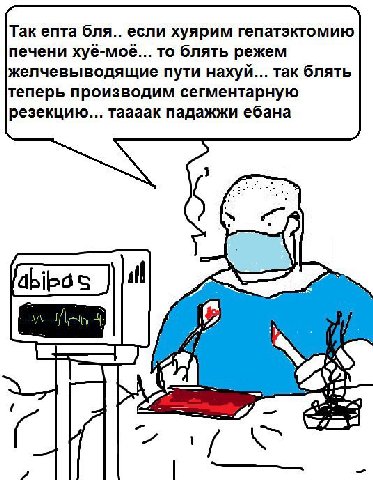 Так епта бля.. если хуярим гепатэктомию печени хуё-моё... то блять режем желчевыводящие пути нахуй... так блять теперь производим сегментарную резекцию... таааак падажжи ебана oN а и 9