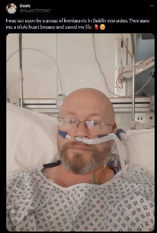 Davis set upon a group of immigrants 2 in Dublin yesterday. They gave me heart bypass and saved my life