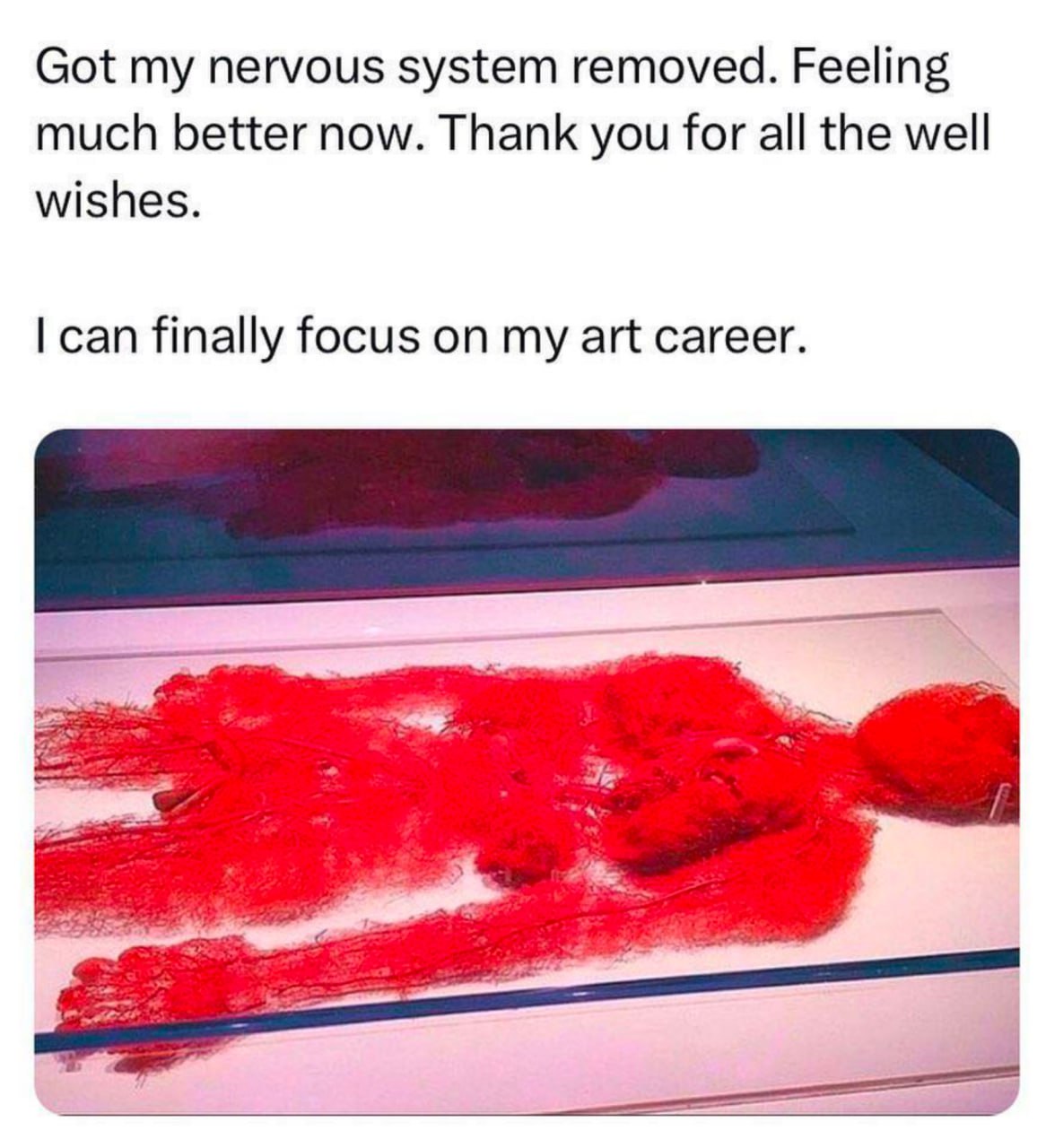 Got my nervous system removed. Feeling much better now. Thank you for all the well wishes. can finally focus on my art career.