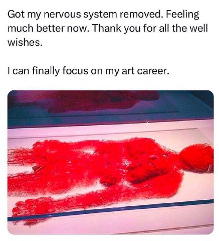 Got my nervous system removed. Feeling much better now. Thank you for all the well wishes. can finally focus on my art career.